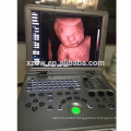 laptop ultrasound color doppler & color ultrasound laptop price